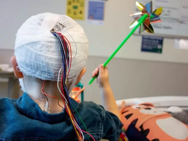 elektroensefalografi-eeg-nedir